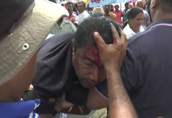 rohitha-mp-wound (3)